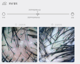홍삼 캔디로 탈모치료 한다...? 관련 이미지 3
