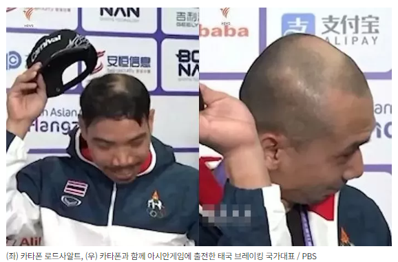브레이킹댄스 헤드스핀 하면 머리카락 빠진다? 탈모 모낭손상? 관련 이미지 1