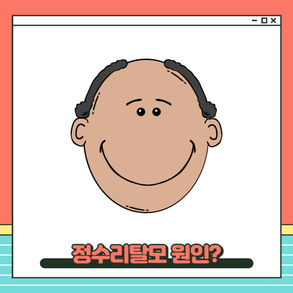 비수술탈모치료 정수리탈모 체계적으로 관련 이미지 2