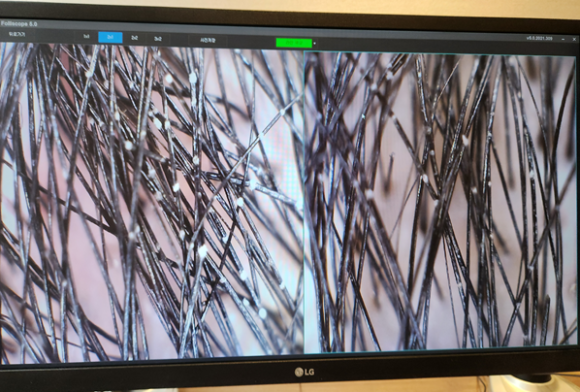 White particles stuck to the hair—could this be a sign of hair loss? image 1