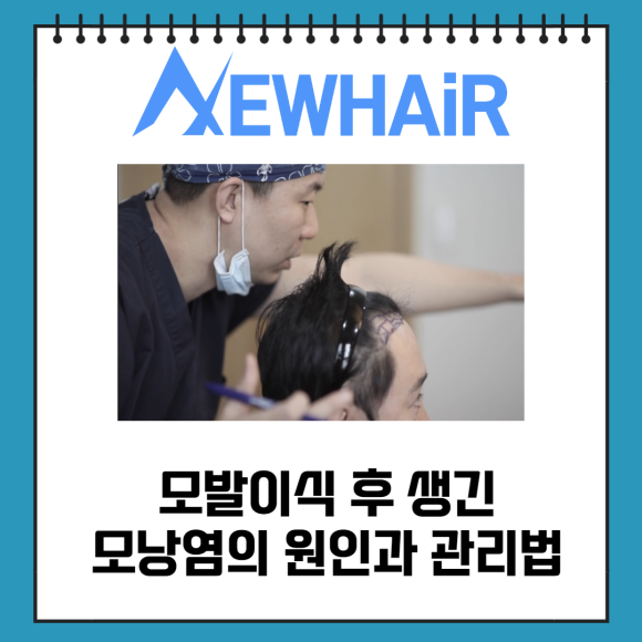 머리심기 모발이식 생존율을 높이기 위해서 관련 이미지 4
