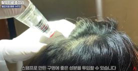 탈모치료 MTS의 효과(모발재성장) 최신논문 관련 이미지 5