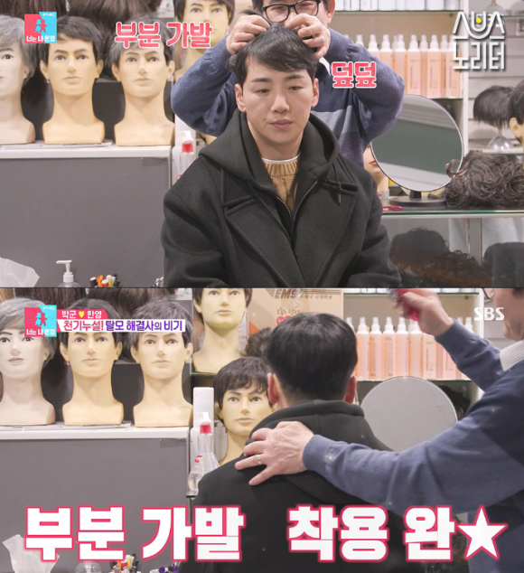 연예인들이 선택하는 탈모치료법? 가발에서 모발이식까지 관련 이미지 3