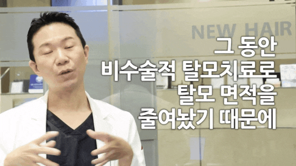 탈모치료방법, 비수술로 해결될까요? 관련 이미지 9