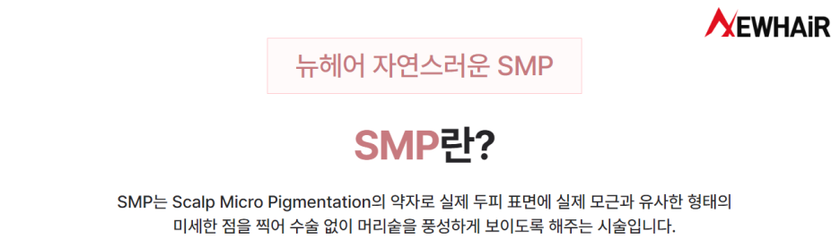 두피문신 SMP, 특징 및 부작용 관련 이미지 2