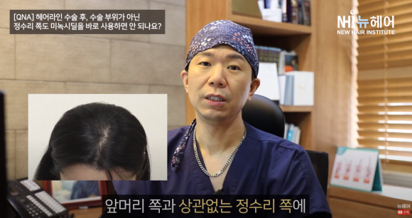 헤어라인 교정 후 미녹시딜은 언제부터 사용 가능할까? l 모발이식ㅣ미녹시딜 사용법 관련 이미지 2