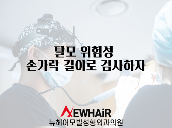 탈모 위험성 손가락 길이로 검사하자 관련 이미지 1
