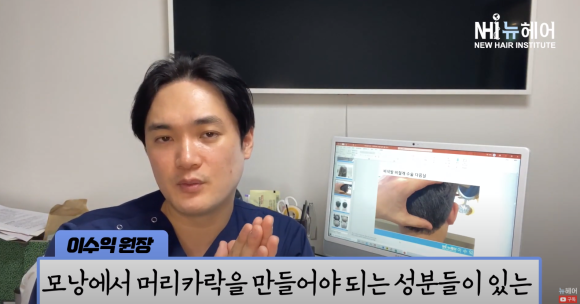 모발이식 실패? 이식모가 빠질 수 있나요? 관련 이미지 16