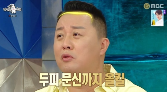 연예인들이 선택하는 탈모치료법? 가발에서 모발이식까지 관련 이미지 4