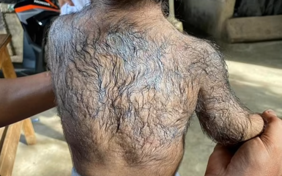 Why Does the Ministry of Food and Drug Safety Tell You to Keep Children Away from Minoxidil Application Sites? image 1