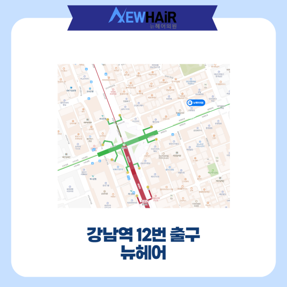 모낭주사 남자탈모 여자탈모 치료해요 관련 이미지 6