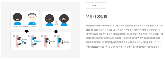 모발이식 수술 생착률 차이점은? 관련 이미지 10