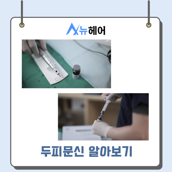두피문신가격과 따져봐야 할 것은? 관련 이미지 2