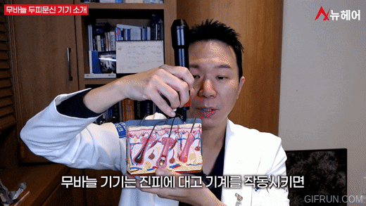 정수리 탈모, 가르마 탈모에 효과적인 무바늘 두피문신! 관련 이미지 5