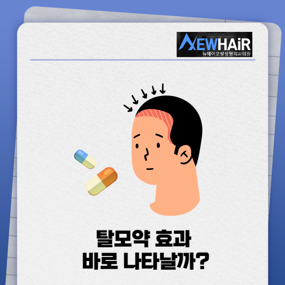 탈모약처방 찾고있다면 관련 이미지 3