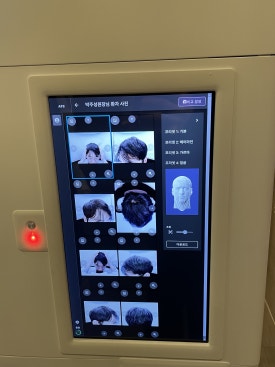 여성탈모치료, 비수술적 및 수술적 맞춤형 관리 방법 관련 이미지 2