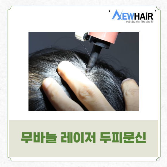 탈모문신으로 탈모 고민은 이제 그만 관련 이미지 5