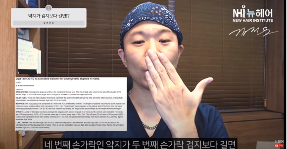 유전성 탈모 예측, 손가락 길이로 한다? 관련 이미지 2