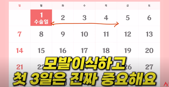 안무가 배윤정 씨, 출산 후 모발이식으로 찾는 자신감 관련 이미지 4