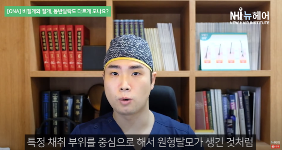 비절개 모발이식과 절개 모발이식, 동반탈락도 다르다? 관련 이미지 7