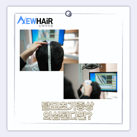 탈모초기증상 의심된다면? 관련 이미지 1