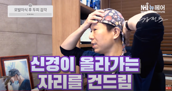 모발이식 후 두피 감각이 없다면... l 회복 기간 관련 이미지 2