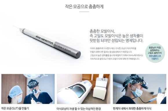 모발이식 나이 알아보고 결정해요 관련 이미지 5