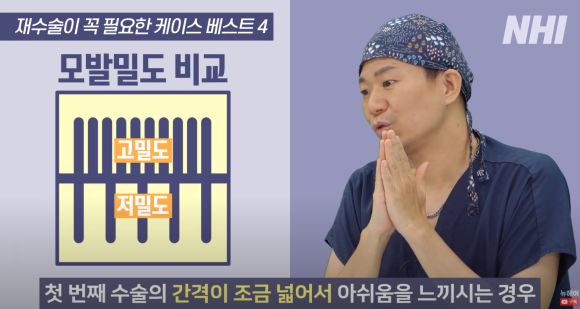 [뉴헤어] 모발이식 재수술하는 경우 정리해드립니다 l  이마축소술 관련 이미지 3