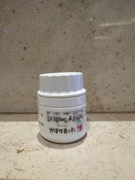 20대 M자 탈모, 약부터 먹어야 할까요? 원형탈모와 구별부터 모발이식 관련 이미지 3