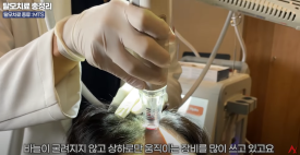 탈모치료 MTS의 효과(모발재성장) 최신논문 관련 이미지 4