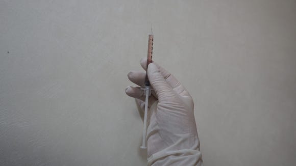 Autologous Cell Hair Loss Treatment, Treatment Using Autologous Follicle Cells image 5