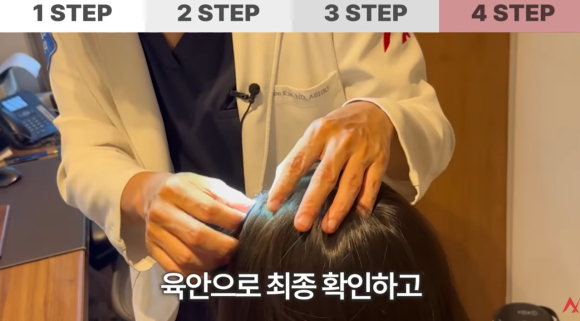 탈모검사, 언제부터 얼마나 자주 받아야 할까? 관련 이미지 4