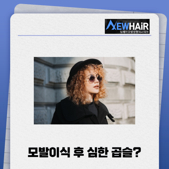 모발이식 m자 탈모커버 확실하게 관련 이미지 4