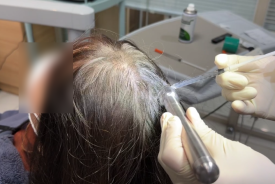 연령대별 탈모특징, 탈모 변화 과정은 어떨까? 관련 이미지 12