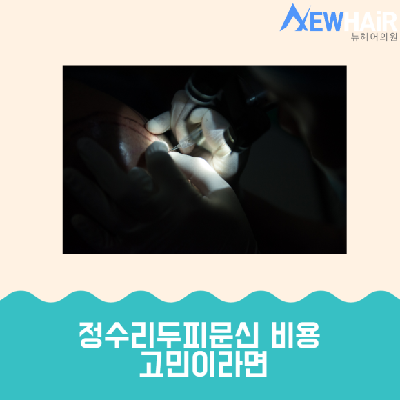 정수리두피문신 비용 고민이라면 관련 이미지 1