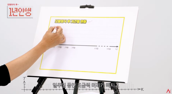 모발이식 암흑기 언제까지? 쉐딩과 차이, 이유 관련 이미지 3