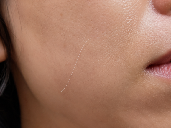 Why You Suddenly Grow a Long White Hair on Your Body image 3