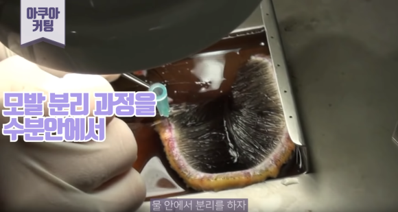 뉴헤어 모발이식 수술 차별점 l 장비 소개 관련 이미지 5