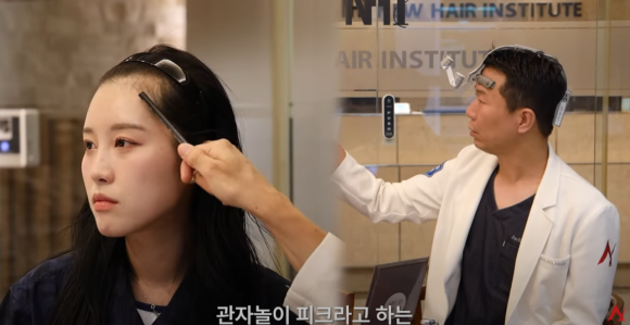Important Design Points for Hairline Hair Transplantation in Transgender (Gender-Affirming) Patients image 2