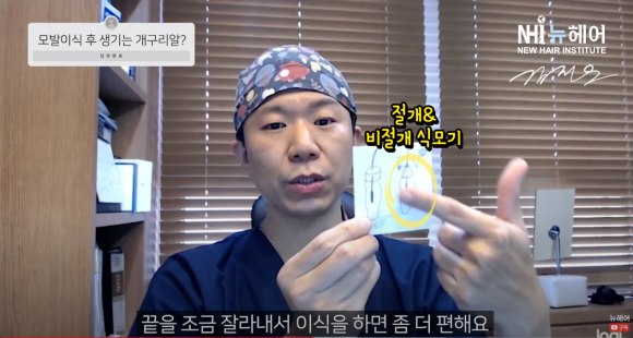 모발이식 개구리알의 진실 l 나도 생길까? 관련 이미지 6
