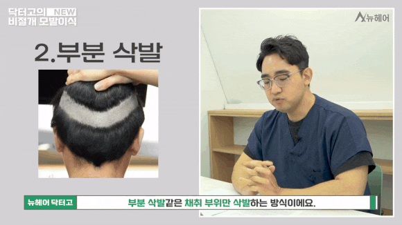 비절개모발이식 종류와 선택 가이드 관련 이미지 6