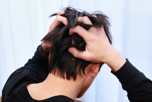 Oily Scalp? Dry Scalp? What You Need to Know Before Worrying About Hair Loss image 1