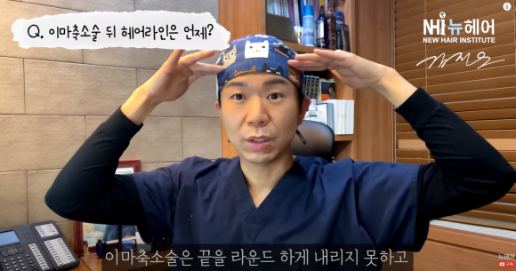 이마축소술 후 헤어라인교정(모발이식) 언제 할 수 있을까? 관련 이미지 2