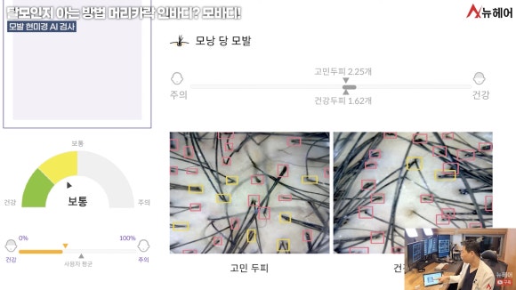 탈모진단병원, 관련 이미지 4