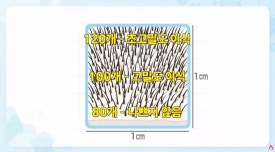 모발이식 재수술 FAQ : 밀도 부족·헤어라인·뻗침, 다시 심으면 해결될까요? 관련 이미지 2