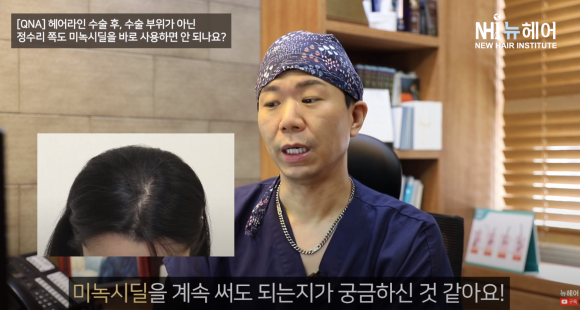 헤어라인 교정 후 미녹시딜은 언제부터 사용 가능할까? l 모발이식ㅣ미녹시딜 사용법 관련 이미지 3