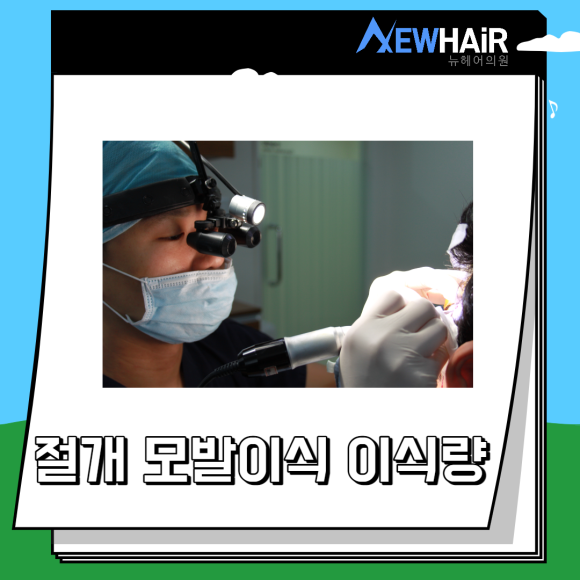 절개 모발이식 수술 총정리 관련 이미지 3