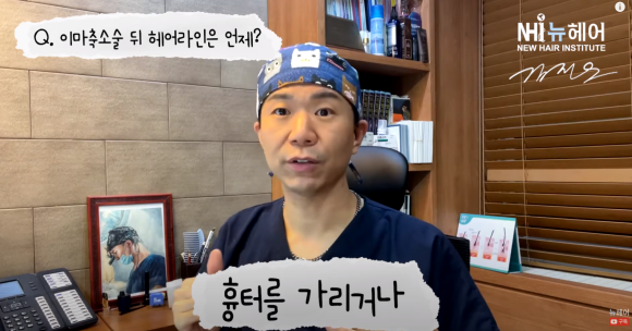 이마축소술 후 헤어라인교정(모발이식) 언제 할 수 있을까? 관련 이미지 1