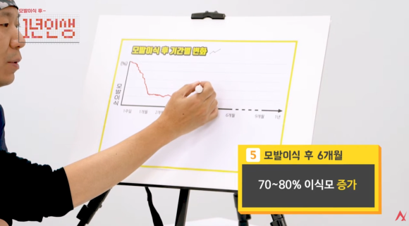 모발이식 암흑기 언제까지? 쉐딩과 차이, 이유 관련 이미지 7