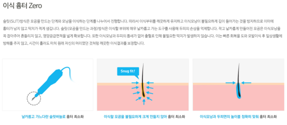 모발이식방법 자세히 알고 가세요 관련 이미지 5